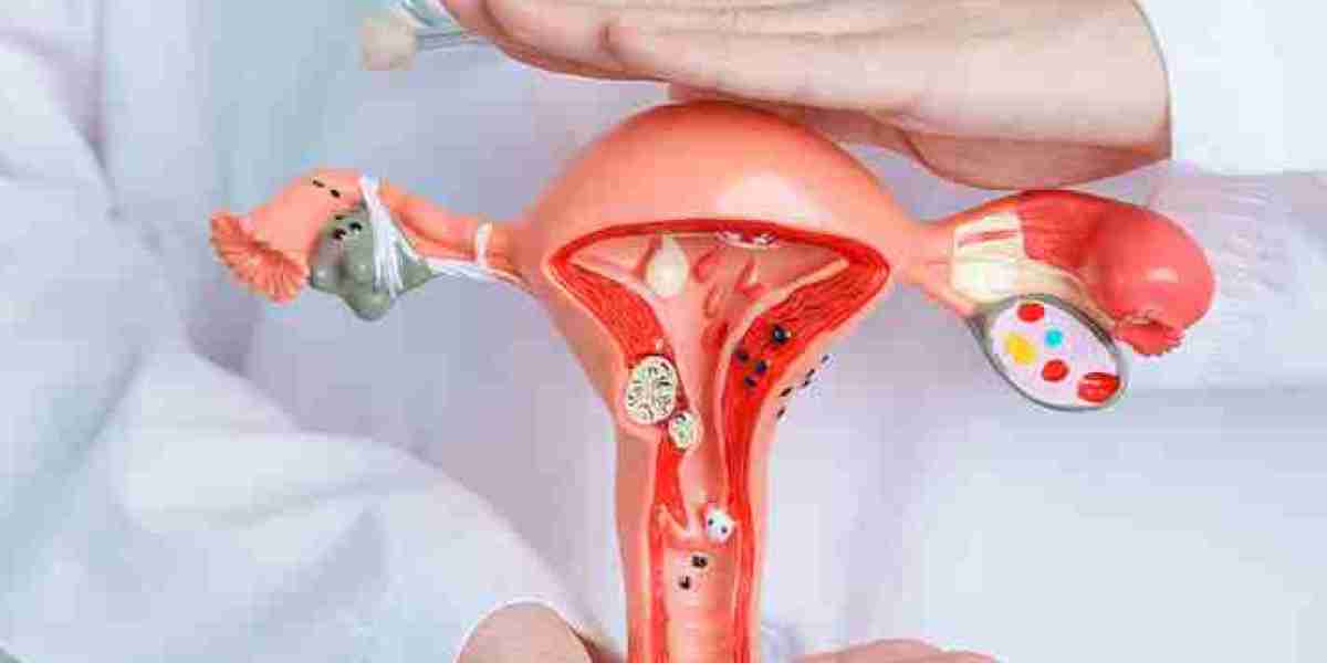 What Is Perimenopause and How Long Does It Last?