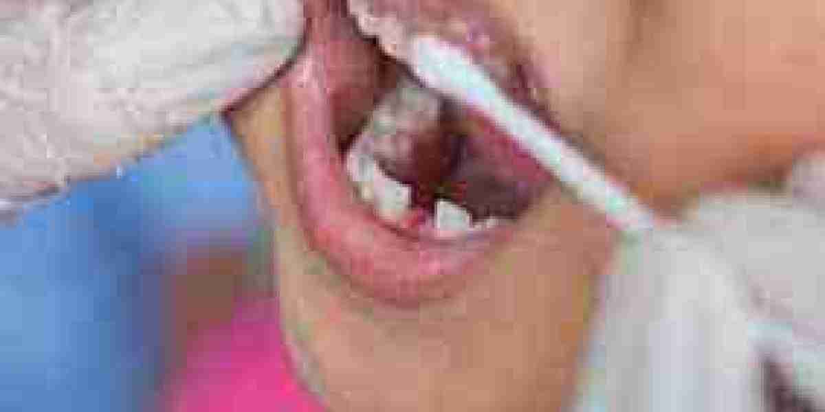 Teeth Desensitizer Market Gaining Momentum Amid Higher Dental Visits and Homecare Product Adoption