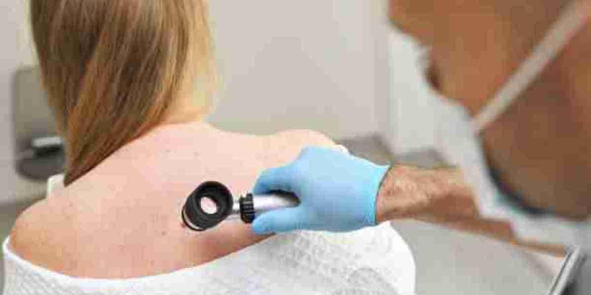 What to Expect from a Dermatologist in Riyadh