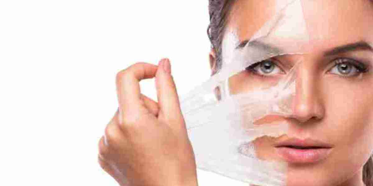Chemical Peeling vs. Laser Treatment: Full Comparison