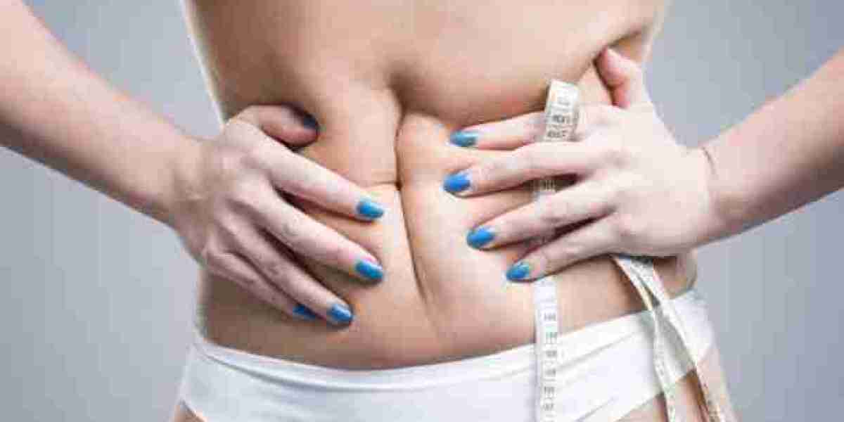 Expert Tummy Tuck in Riyadh: What to Expect