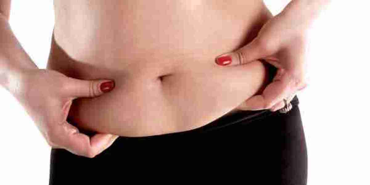 How to Prepare for Obesity Surgery in Riyadh