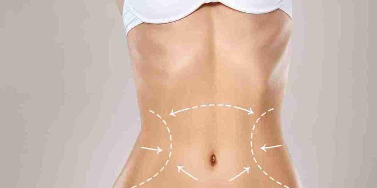 How Much Fat Can Be Removed with Laser Lipo?