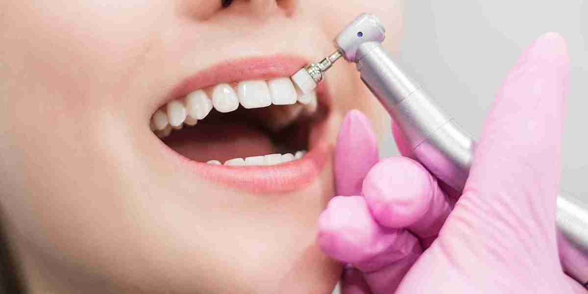 Can Teeth Scaling Prevent Cavities?