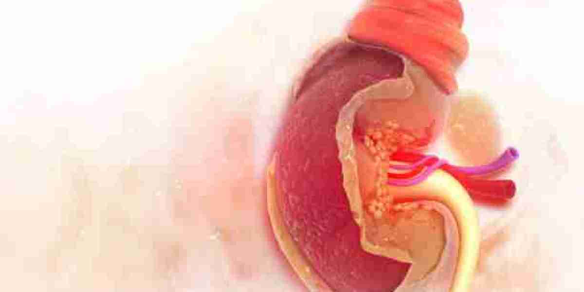 Gastric Balloon in Riyadh Procedure Explained Simply