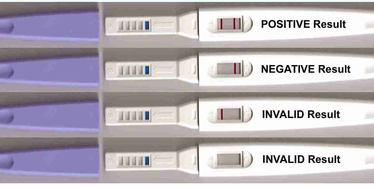 Ovulation Test Kit Market: Exploring Opportunities, Growth, Trends, and Consumer Demand Insights