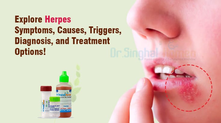 Understanding Symptoms and Causes of Herpes- An Overview