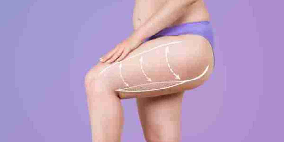 Expert Tips for Thigh Lift Surgery in Riyadh