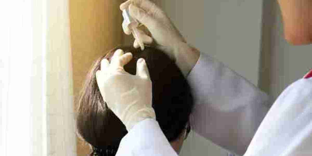 Exosome Therapy – Riyadh’s Top Hair Loss Solution