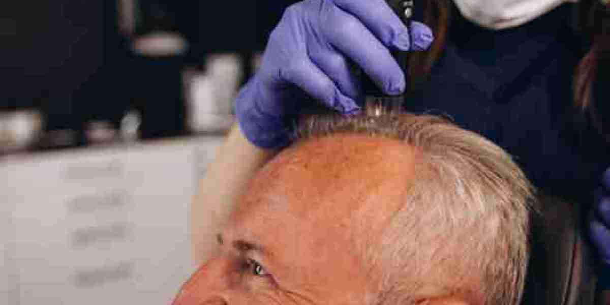 From Hair Loss to Hair Health – Exosomes Therapy in Riyadh Can Help