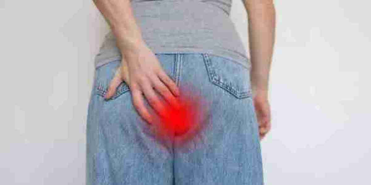 Your Guide to Laser Treatment of Hemorrhoids in Riyadh