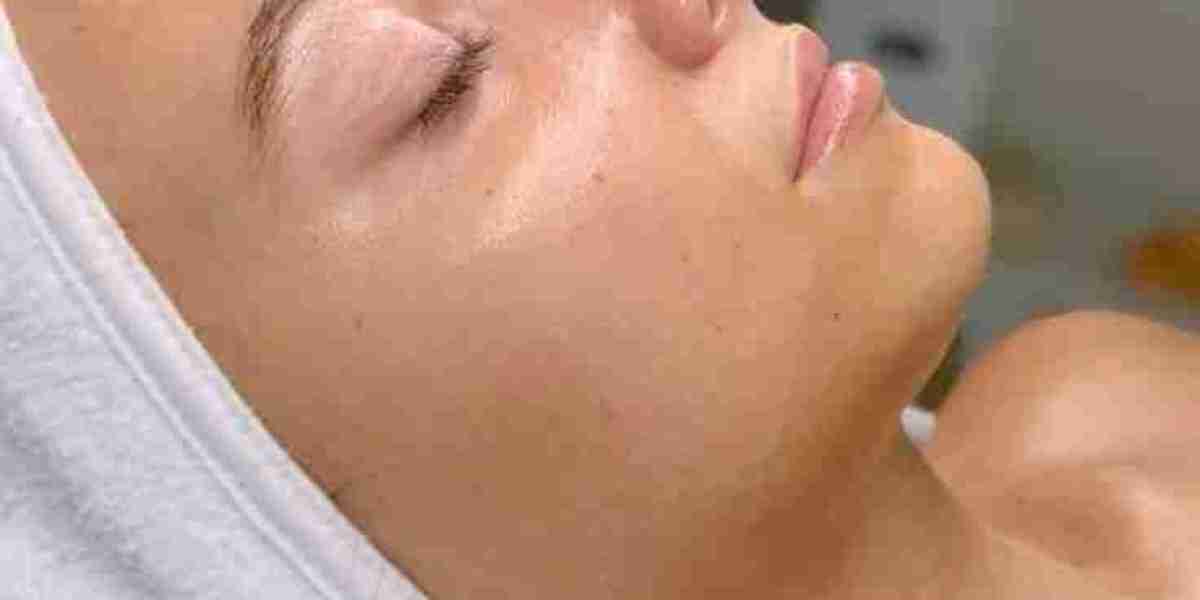 Best Clinics for Chemical Peels in Riyadh