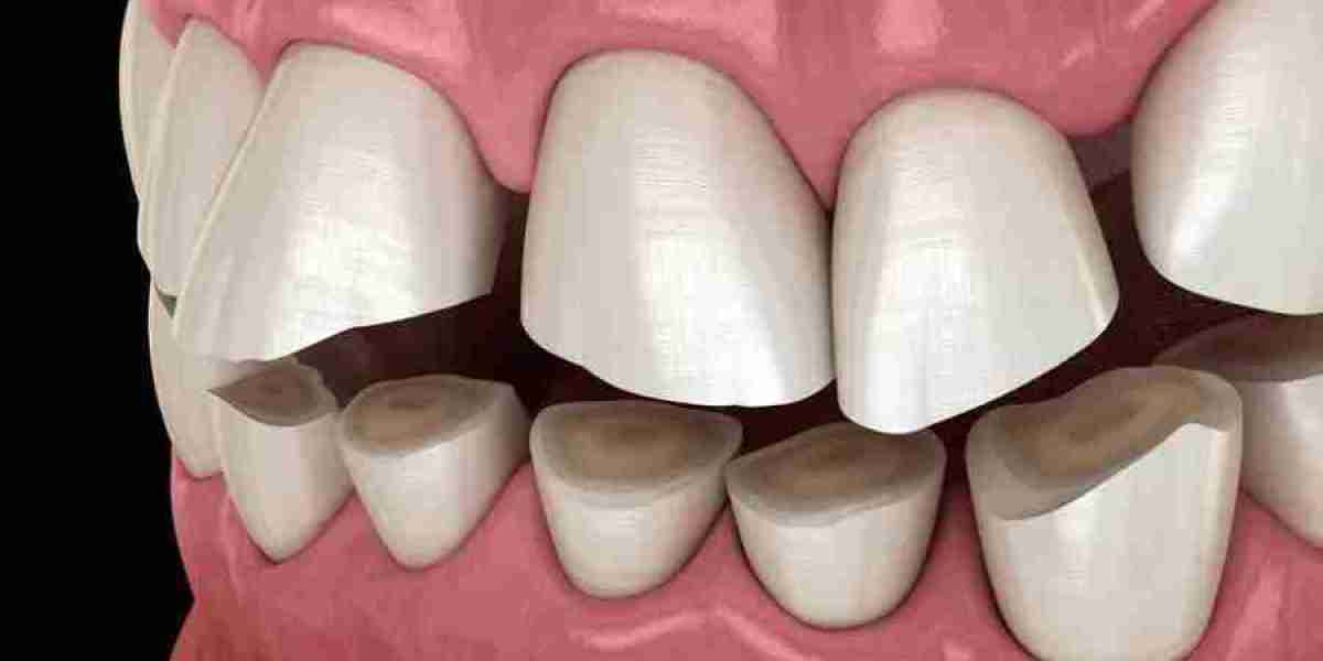 Why Does My Jaw Hurt After Sleeping?