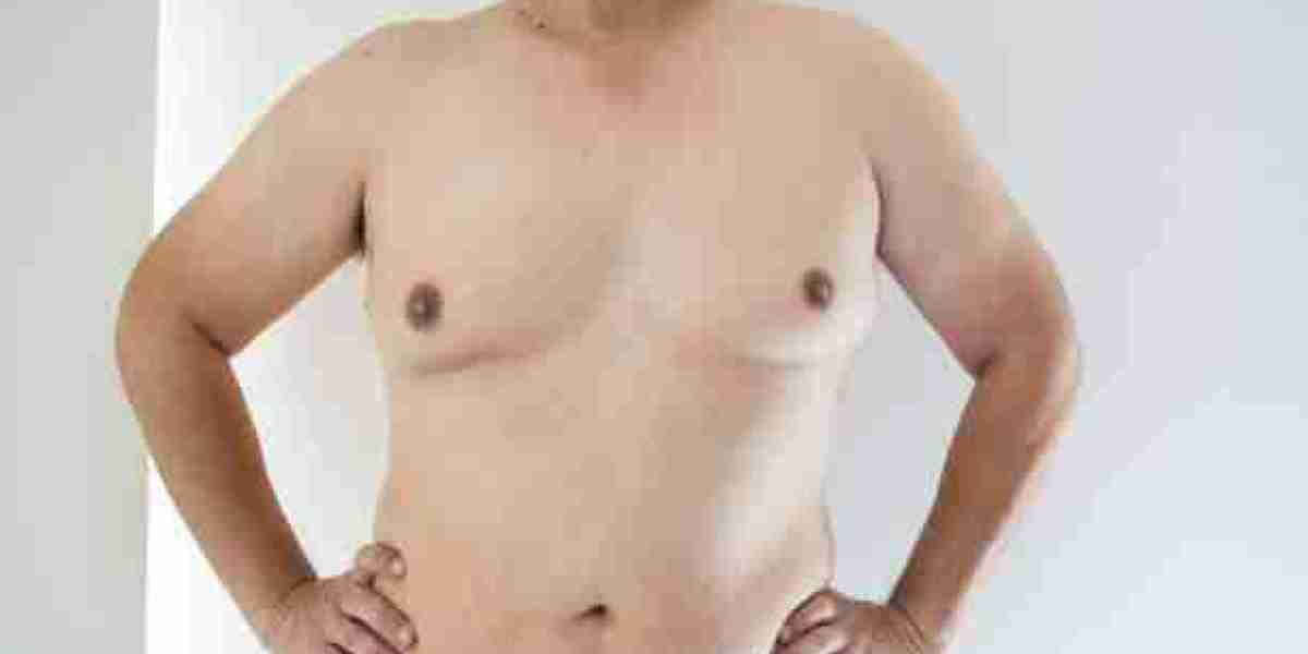 Trusted Gynecomastia Surgery in Riyadh Clinics