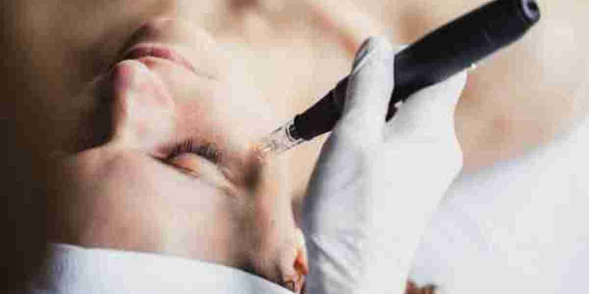 What Derma Pen Can Do for You