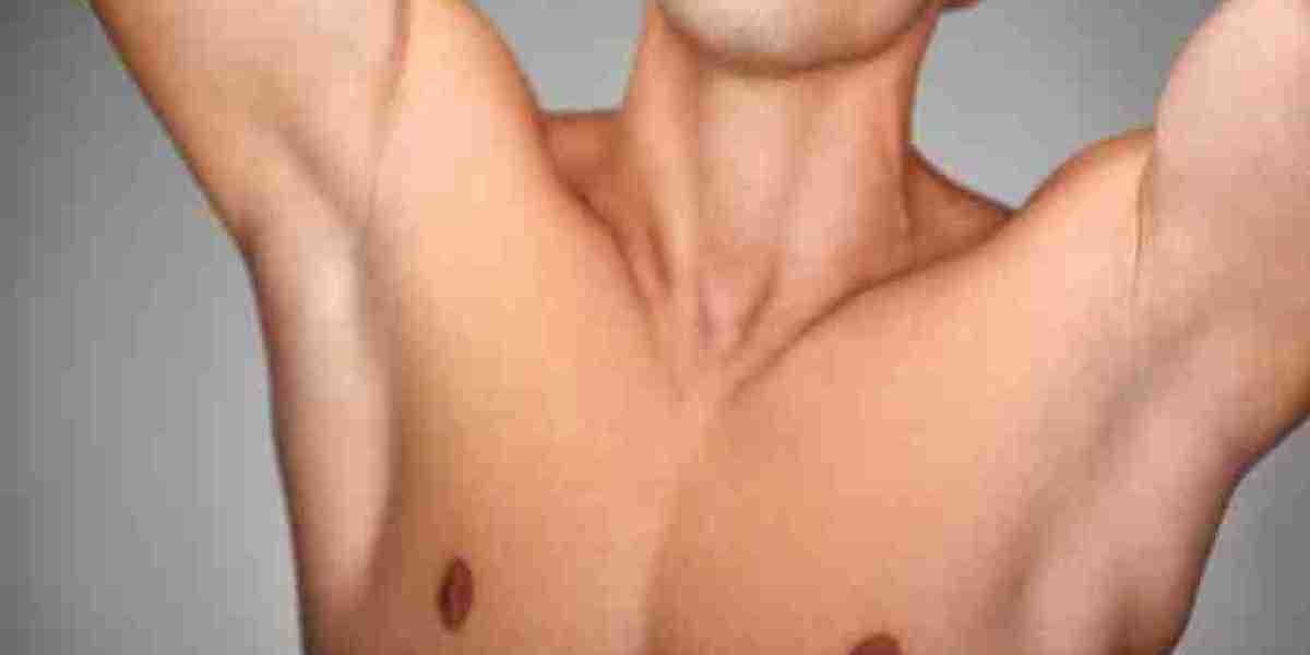 Gynecomastia Surgery in Riyadh for a Sculpted Chest