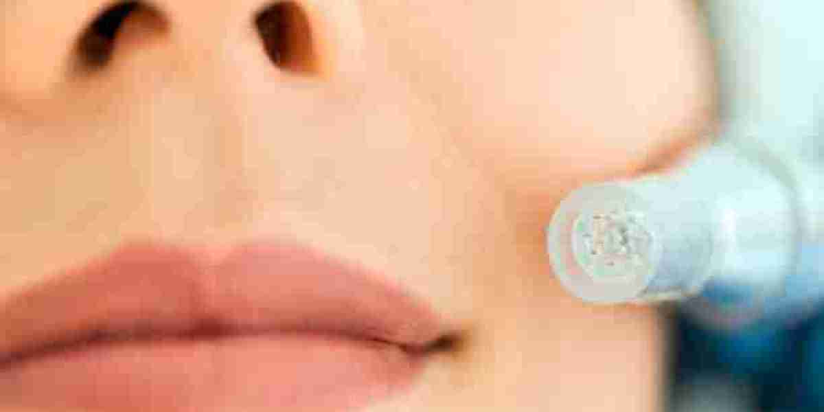 Say Goodbye to Acne Scars with Derma Pen