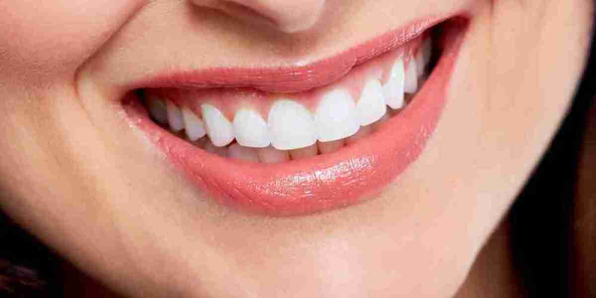 How to Reduce Sensitivity After Teeth Whitening?
