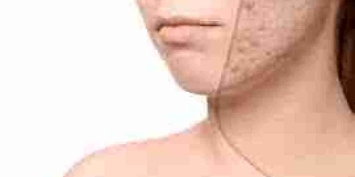 Scar Removal That Works Without Harsh Side Effects