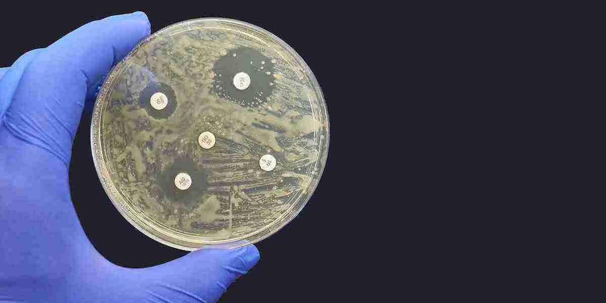 Antimicrobial Polymer Films Market 2025: Trends Driving Sustainable Packaging Solutions