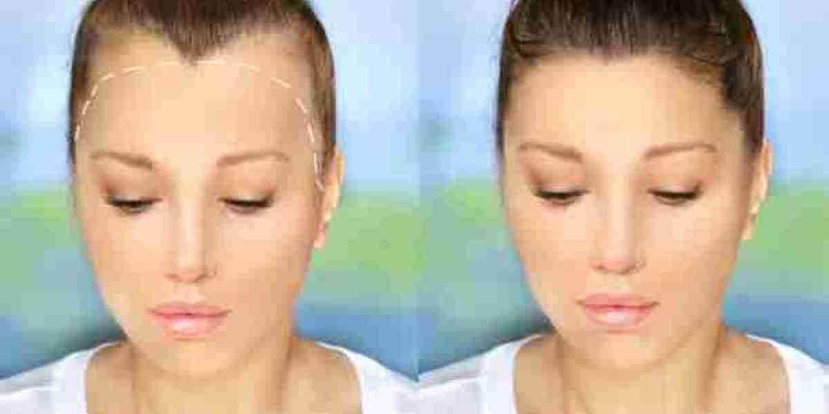 زراعة الشعر في الرياض للنساء: هل هي مجدية؟