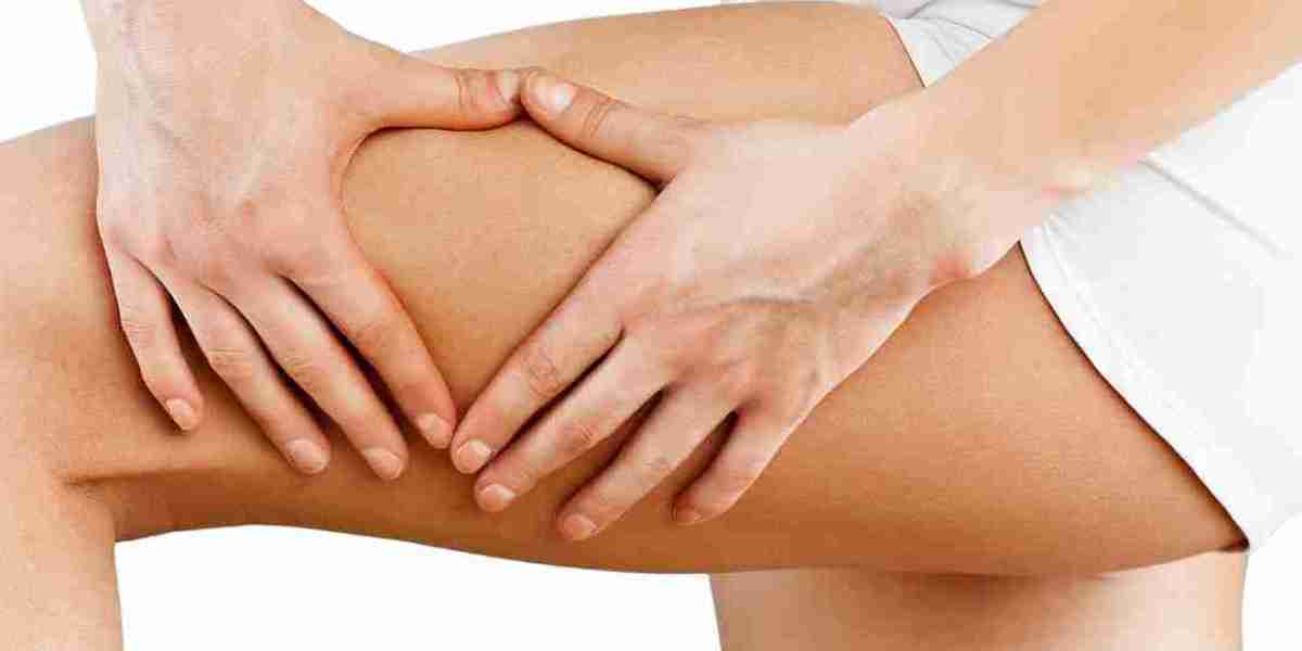 Cellulite Removal Creams: Do They Really Work