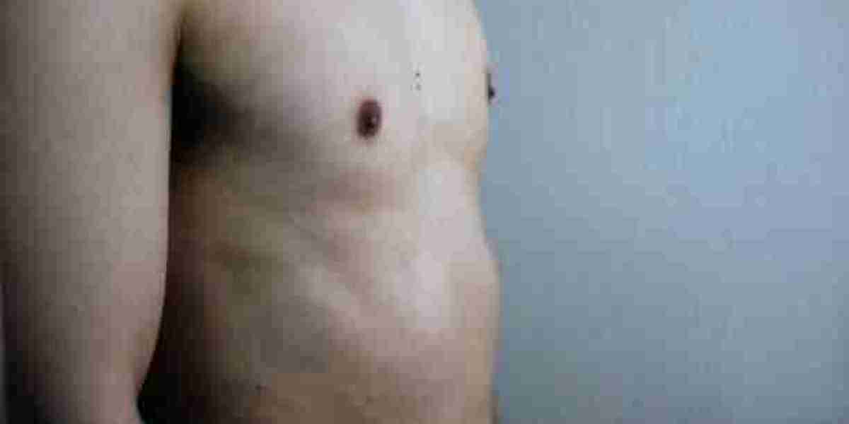 Choosing the Right Gynecomastia Surgeon in Riyadh