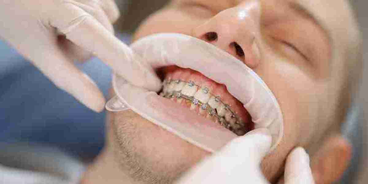 What Happens if You Don’t Get Orthodontic Treatment?