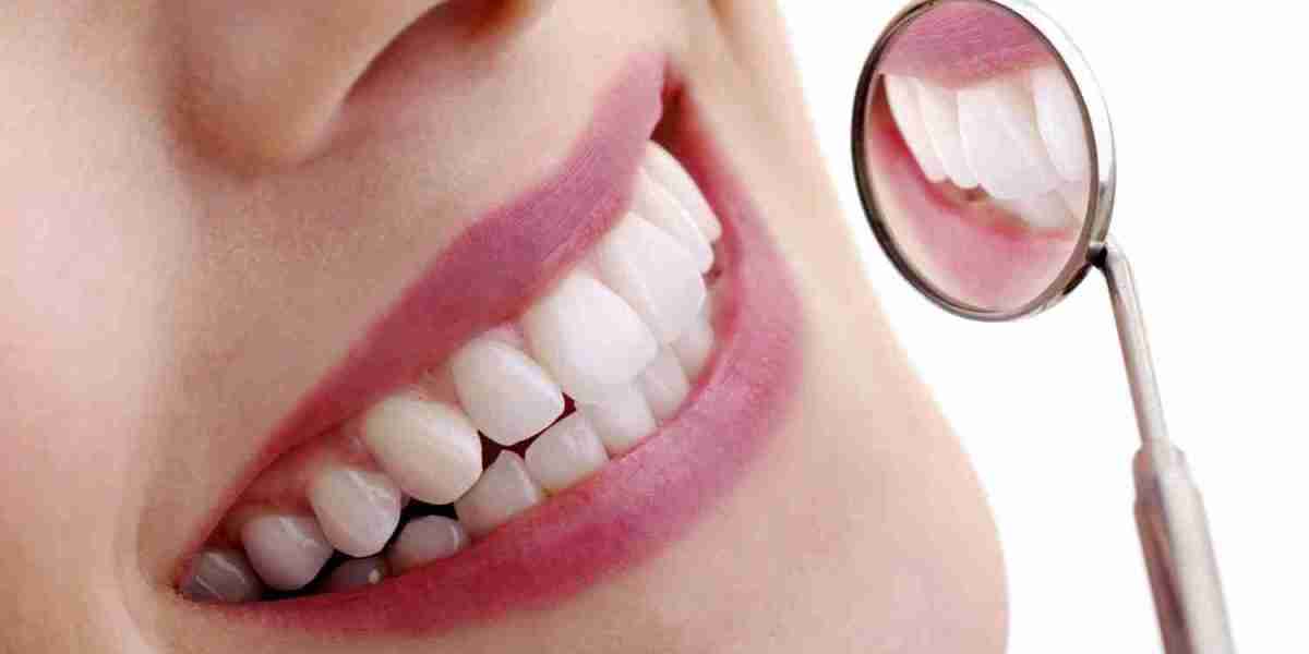 Can Teeth Whitening Make Teeth Sensitive?