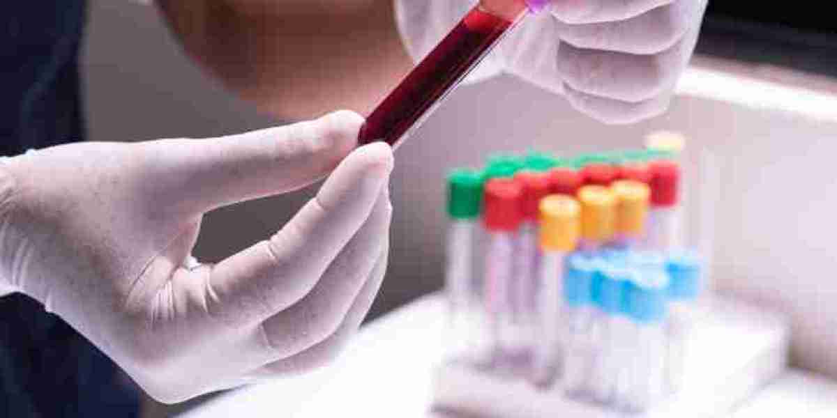 Mercado de Diagnóstico in Vitro en Chile: Crecimiento y Perspectivas para 2024-2034