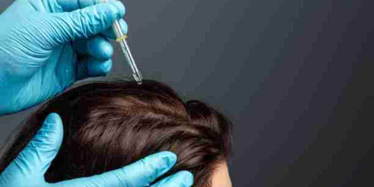 Regain Your Confidence: Exosome Therapy for Hair Loss in Riyadh