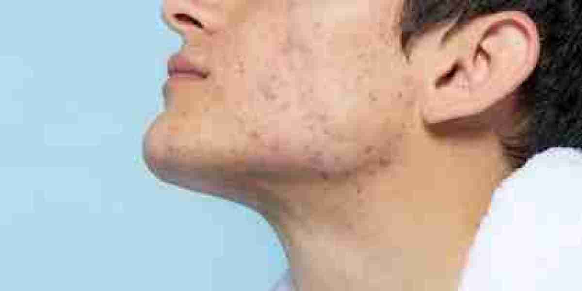 Riyadh Dermatology: Expert Care