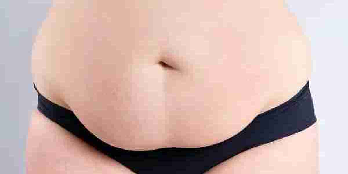 What’s the Difference Between a Mini and Full Tummy Tuck?