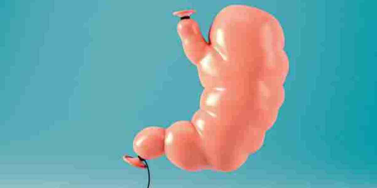 Riyadh Obesity Surgery: Transform Your Health Today