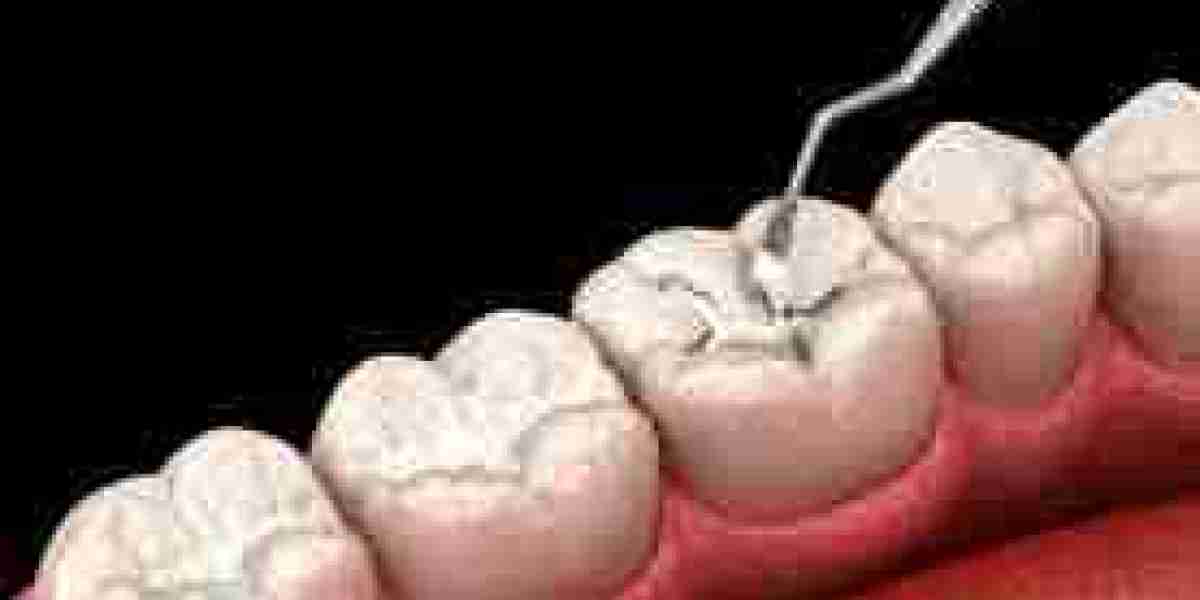 Tooth Filling Materials Market Opportunities and Challenges Shaping the Dental Industry Landscape