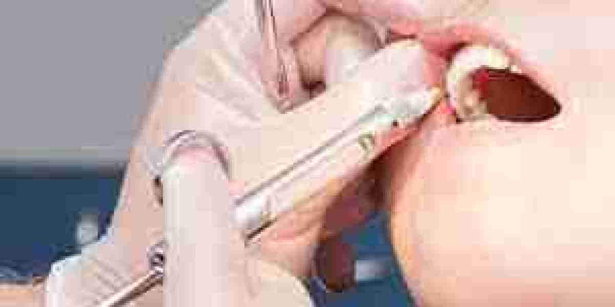 Dental Anaesthesia Market regulatory framework and compliance trends impacting growth