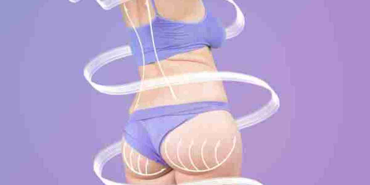 Benefits of Thigh Lift Riyadh