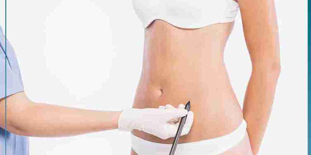 What Questions Should I Ask Before Booking Abdominal Liposuction in Dubai?