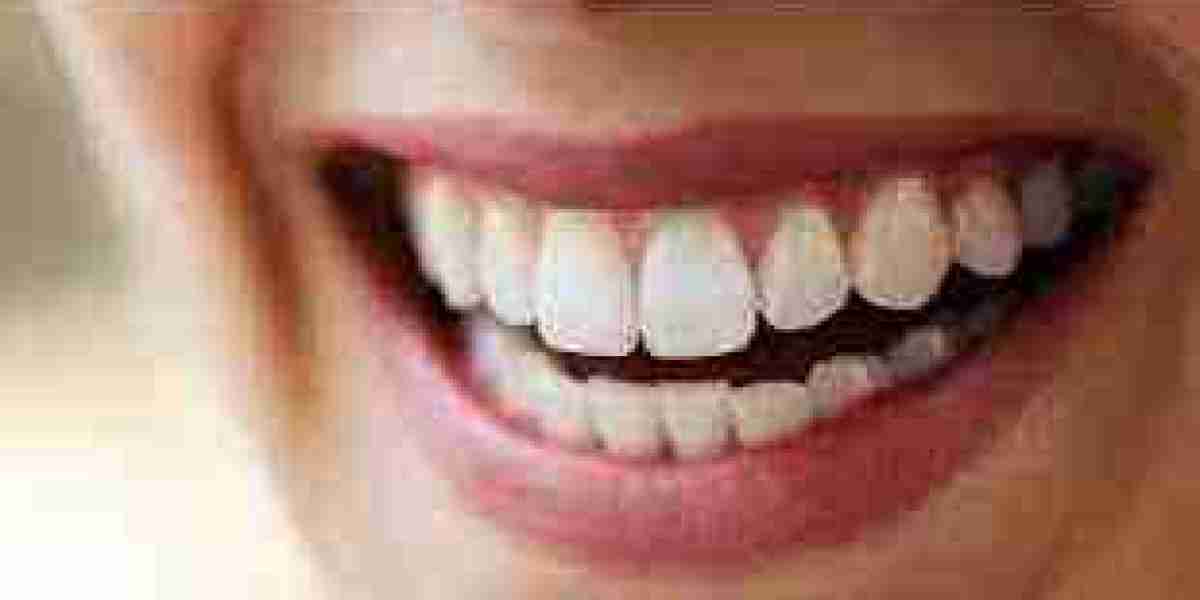 What’s the Best Age to Get Full Mouth Rehabilitation?
