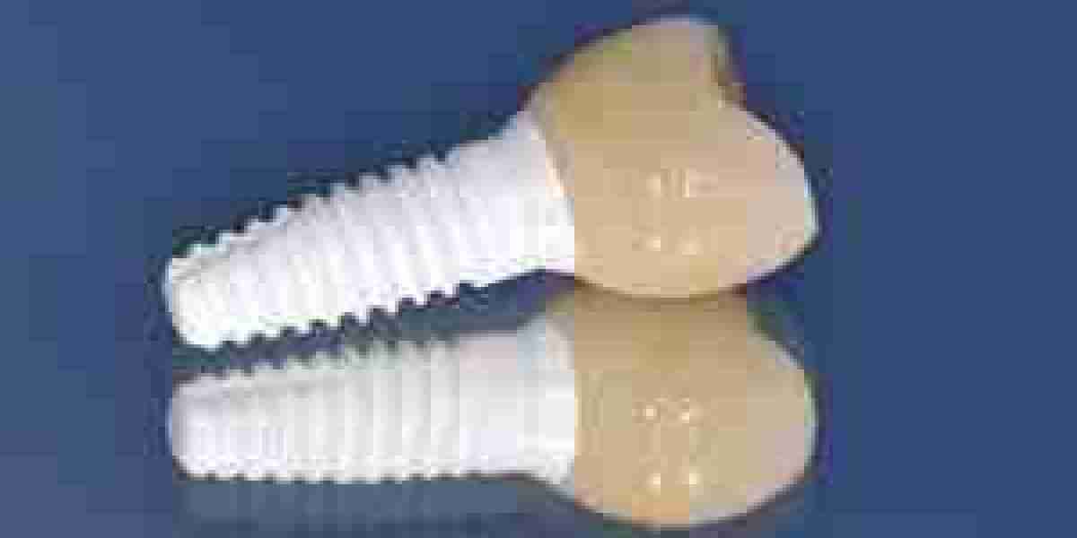Dental Ceramic Market supply chain analysis and global distribution channels