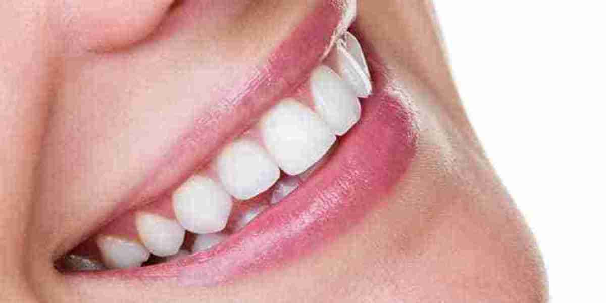 Is Charcoal Safe for Whitening Teeth?