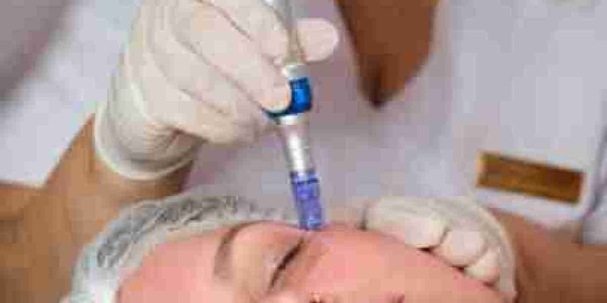 Can a Derma Pen Reduce Acne Scars?