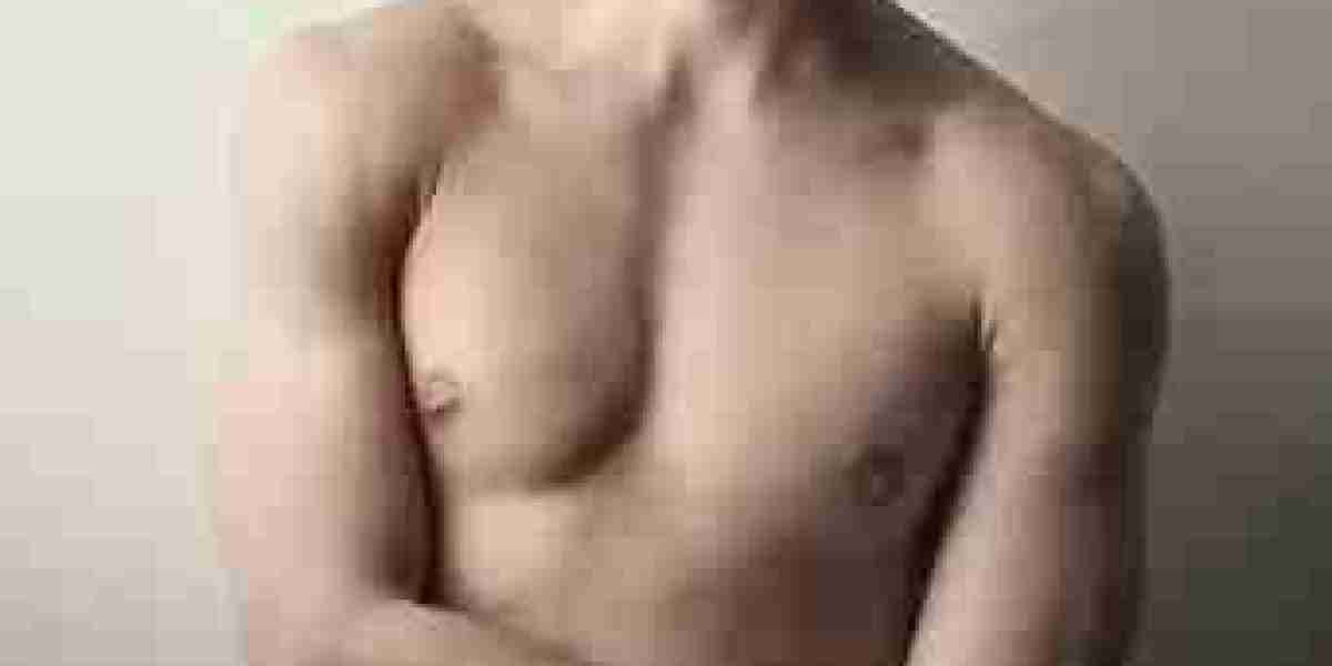 Riyadh Gynecomastia Experts: Achieving a Masculine Chest Contou