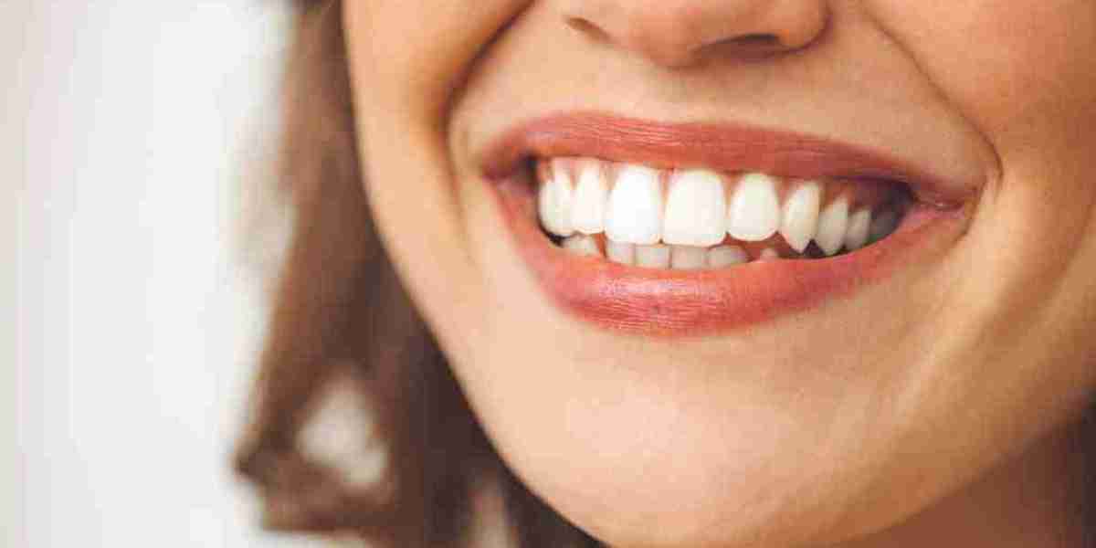 Where Can I Buy Nano Teeth Whitening Products?