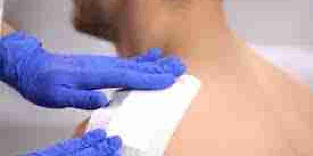 Medical Adhesives Market Development: Innovations, Applications, and Future Growth Opportunities