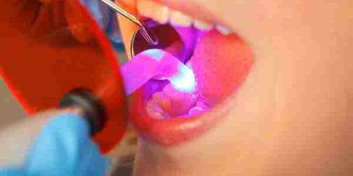 What’s the Best Filling for Front Teeth?