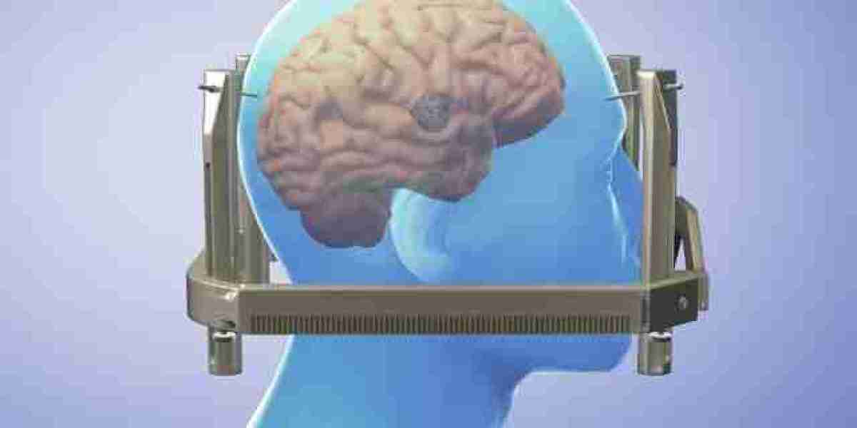 Advancements in Neurosurgery: The Rise of Gamma Knife Radiosurgery in India