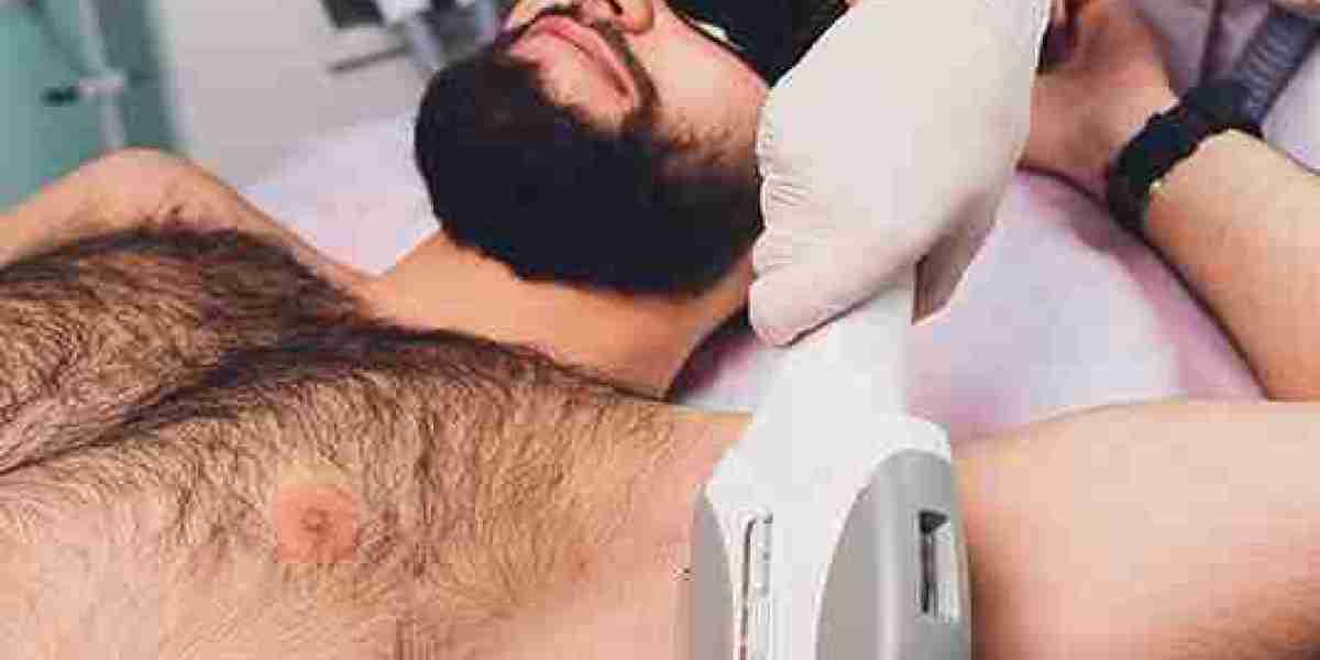 Does Laser Hair Removal in Dubai Work for Hormonal Hair Growth?