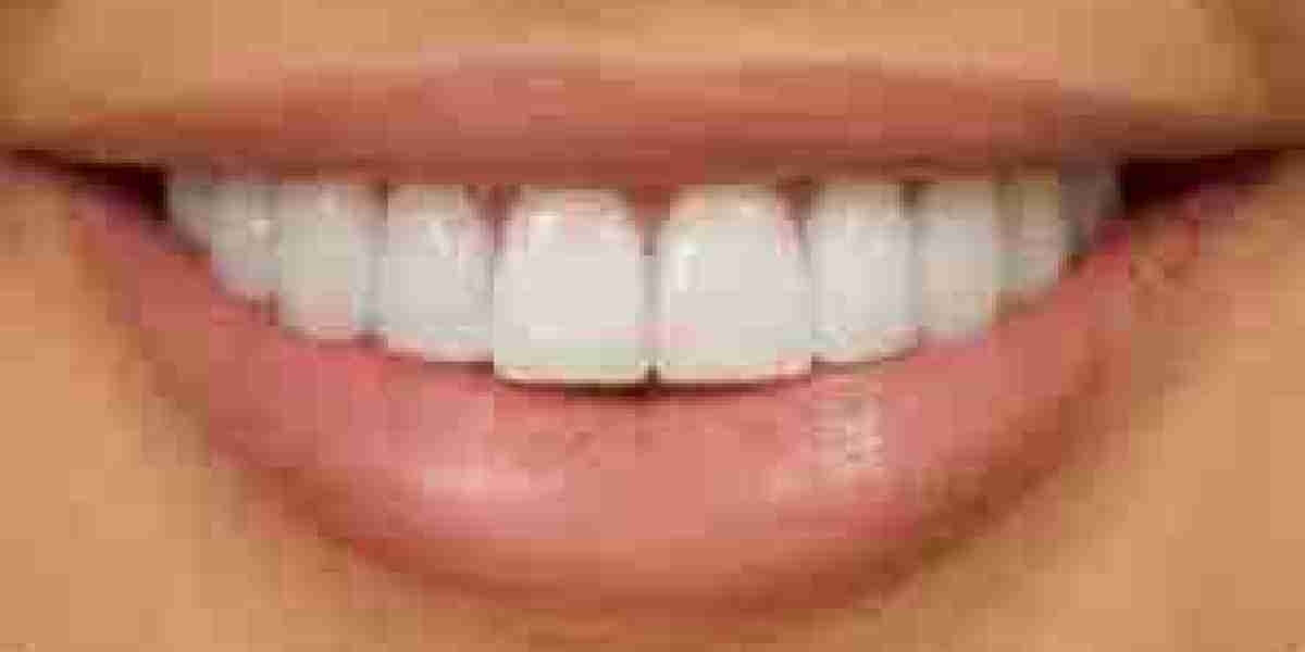 How Your Diet Impacts Oral Health: Tips from a Dental Hygienist