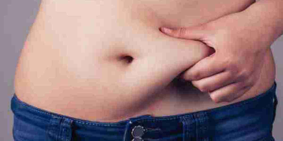 Riyadh Liposuction for Men: Sculpting a Defined Physique